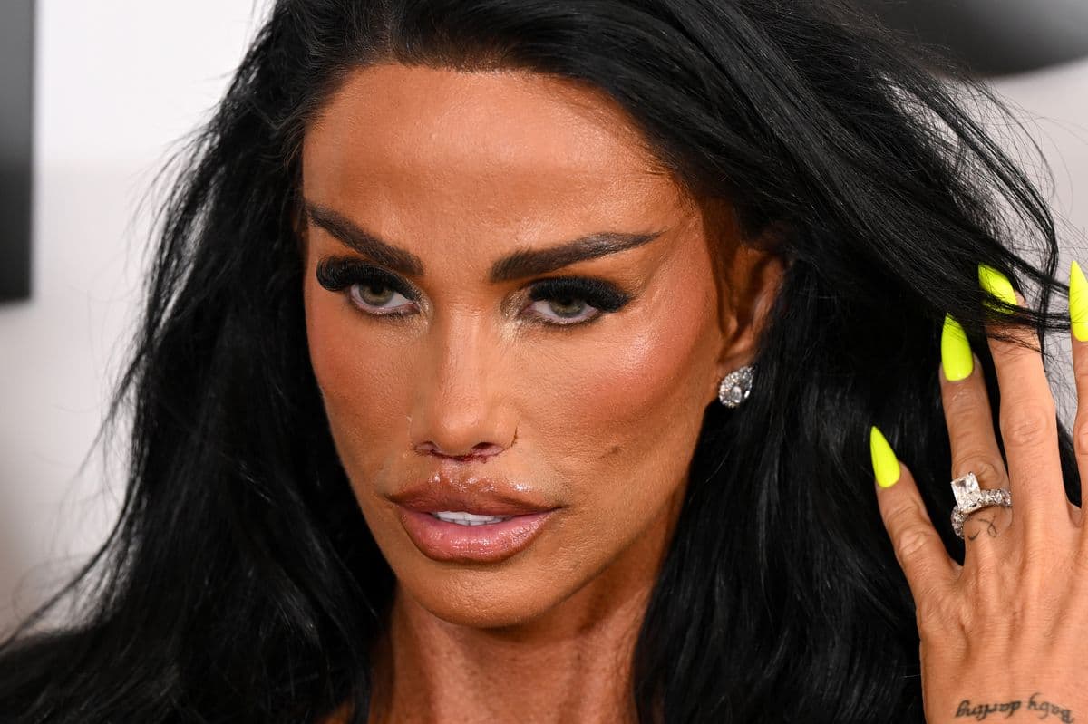 Katie Price reveals results of painful lip corrective surgery at documentary premiere — 1 of 4