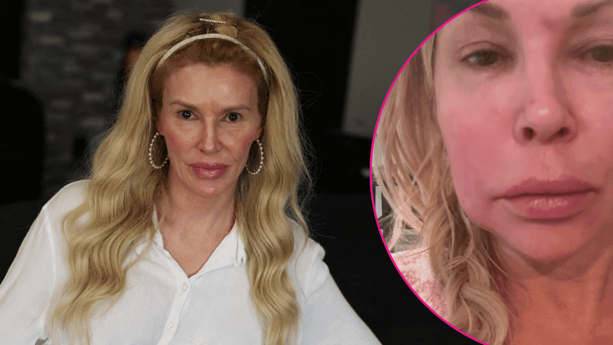 Brandi Glanville Health Nightmare: 'RHOBH' Star Reveals Tumor in Her Lymph Node as Facial 'Parasite' Has Returned